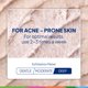 thumbnail image 4 of Exfoliante facial St. Ives Control del Acné 2% Ácido Salicílico, 4 unidades, 4 of 7