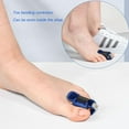 thumbnail image 2 of Happon Toe Splints,4 Pcs Toe Straightener Brace, Overlapping Toe Wrap, Toe Corrector Brace, Adjustable Trigger Finger Splint Foot Accessories for Women Man（Blue）, 2 of 8