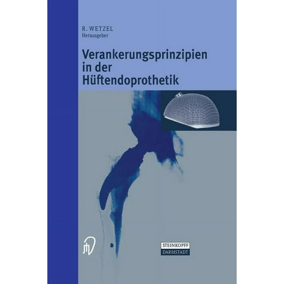 Verankerungsprinzipien in Der HÃ¼ftendoprothetik, (Paperback)