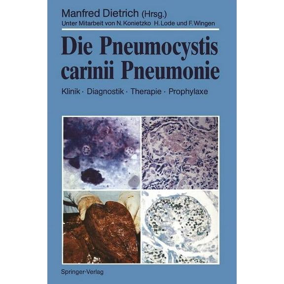 Die Pneumocystis Carinii Pneumonie: Klinik - Diagnostik - Therapie - Prophylaxe, (Paperback)
