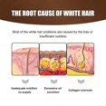 thumbnail image 2 of Jaysuing Anti-White Hair Essence White To Black Hair Essence Scalp Massage Moisturizing Hair Growth Essence -, 2 of 5