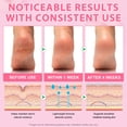 thumbnail image 3 of Cracked Heel Stick with 60% Urea(Peach Flavor), Repair Moisturizing Foot Care, Fast Absorbing, Non-Greasy for Dry, Rough Feet and Skin - 2PACK, 3 of 9