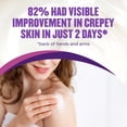 thumbnail image 2 of Gold Bond Age Renew Crepe Corrector Body Lotion, Replenishing & Smoothing Formula, 14 oz., 2 of 9