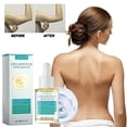 thumbnail image 1 of Fiudx Acete Reafirmante, Suero Corporal Anticelulítico, Loción para Muslos Que Aumenta La Elasticidad, Tratamiento Antiedad para Brazos, Uso Corporal Completo, Confianza Femenina, Fórmula Ligera, 1 of 7