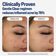 Cetaphil Gentle Clear Mattifying Acne Moisturizer With Salicylic Acid, 3 fl oz