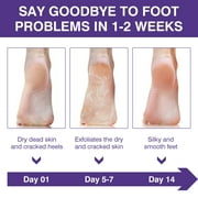 Mooyam 5 Pack Lavender Foot Peel Mask Baby Foot Exfoliant Feet Peel Mask