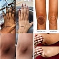 thumbnail image 4 of Suero blanqueador rápido para nudillos oscuros, Corrector de melanina para nudillos de manos, producto eliminador de manchas intensas para el cuidado de la piel negra, 50ml, 4 of 5