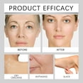 thumbnail image 2 of Facial Wrinkle Cream, Anti Aging Wrinkle Removal Firming Cream, Moisturizing Wrinkle Moisturizing Weakening Fine Lines Nourishing Firming and Lifting Face Cream 50g, 2 of 7