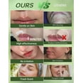 thumbnail image 4 of Painless Facial Hair Removal Cream for Women -   2-in-1 Kit with  Cream | Upper Lip & Chin Hair Remover | At- Depilatory (4 Min, 7 Days Smooth),2.03 Fl Oz, 4 of 6