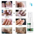 thumbnail image 4 of Spray Caizilan para manos y pies, 20 ml, 4 of 5