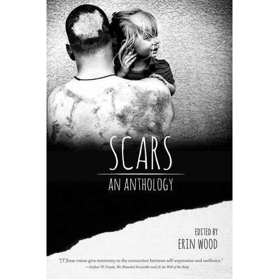 Scars: An Anthology, (Paperback)