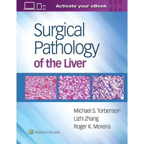 Surgical Pathology of the Liver, (Hardcover)