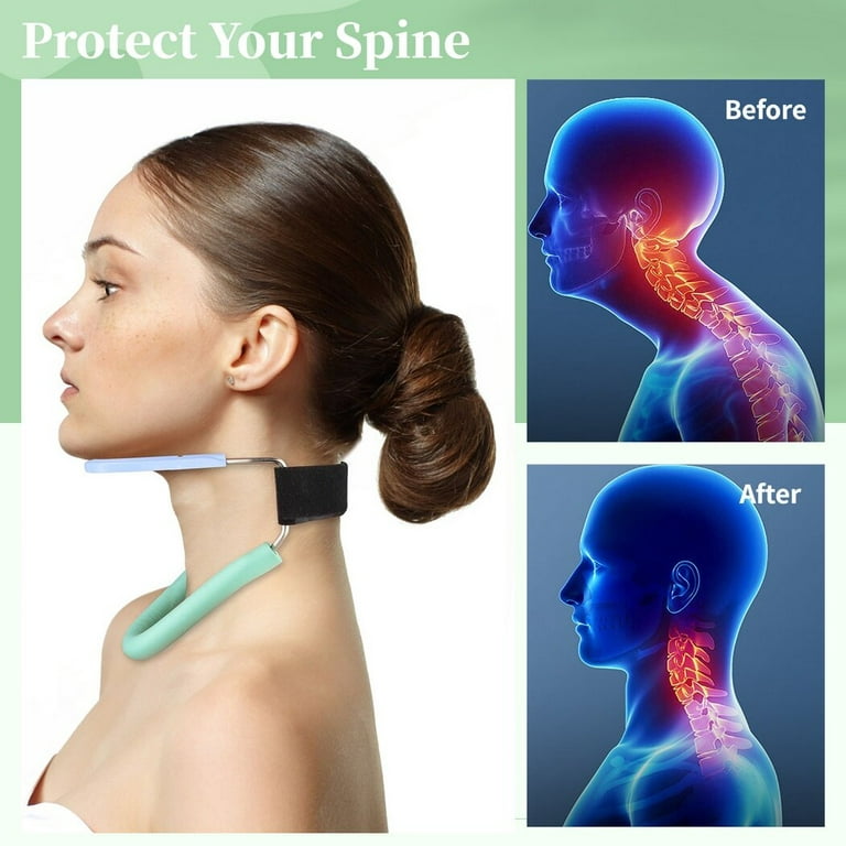 Neck Braces As a Preventive Measure For Cervical Issues