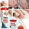 Repair Nail Smoothing Essence Onychomycosis Solution To Solve The Nail Fungus Problem On Toenails And Fingernails 50ml