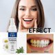 thumbnail image 4 of Whitening Pen with Nano Hydroxyapatite, Fluoride-Free for a Brighter Smile, 4 of 5
