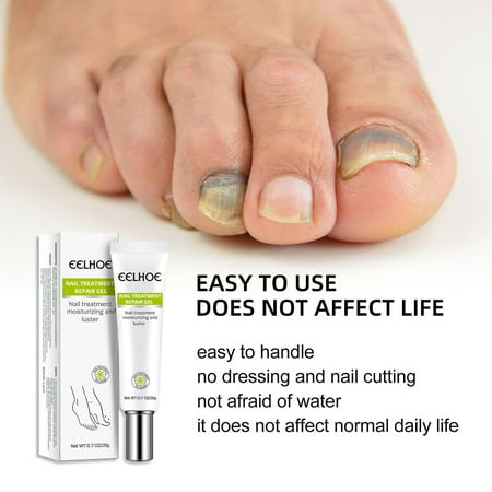 Nail Treatment Feet Care Gel Whitening Toe Nail Fungus Removal Repair Essence | Walmart Canada Nail Treatment Feet Care Gel Whitening Toe Nail Fungus Removal Repair Essence | Walmart Canada