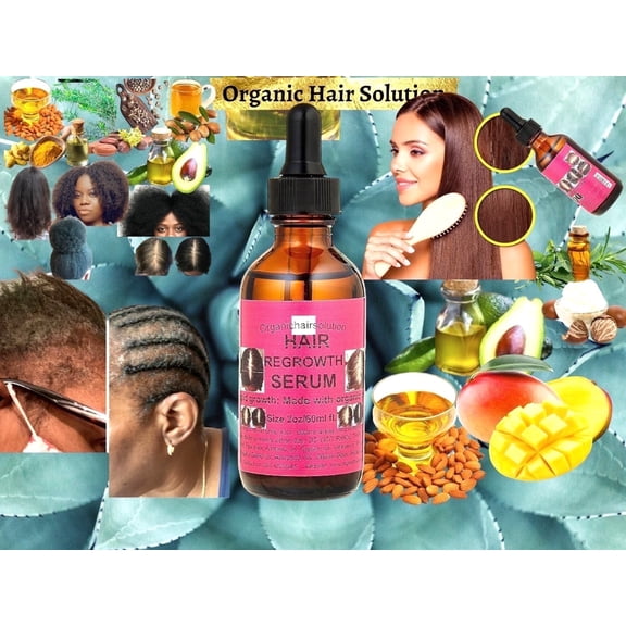 Organic Hair Solution -Edge growth Serum-Oil- Scalp & Hair Strengthening -For Stronger, Thicker Longer Hair-for Split Ends and Dry Scalp- Peppermint-Avocado-Castor-Tea Tree-(2oz