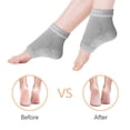 thumbnail image 3 of Calcetines de gel Hilph®2 protección del talón calcetín talón vendaje del talón almohadilla del talón cuidado de los pies almohadilla del talón, alivia los pies secos y los talones recuperación rápida Adepaton LN-2342-2, 3 of 5