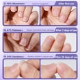 thumbnail image 6 of 2 Pcs 3-in-1 Nail Care Pen Cuticle Oil Pen with Ceramic Cuticle Pusher Moisturize Strengthen Nails Portable Nail Oil Pen for Dry Cracked Nails & Hangnails, Daily Manicure Care, 6 of 8