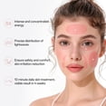 thumbnail image 4 of Máscara de fototerapia SUERBEATY Red Light 7 colores recargable, 4 of 8
