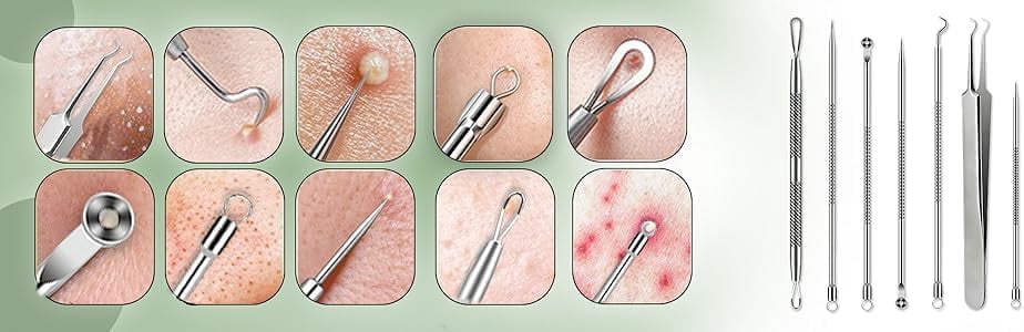 Blackhead Remover Kit with Stainless Steel Tools, Pimple Extractor, Acne Removal & Facial Cleansing Tools for Men & Women