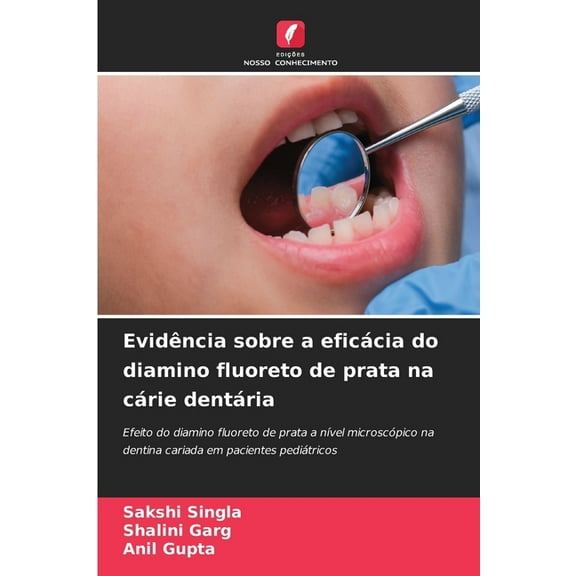 EvidÃªncia sobre a eficÃ¡cia do diamino fluoreto de prata na cÃ¡rie dentÃ¡ria, (Paperback)