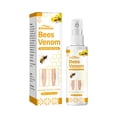 thumbnail image 1 of Varicose Veins Spray, Varicose Veins For Removing Varicose Veins, Spider Veins Removal Spray, Spider Veins Spray, Varicose Veins Spray To Leg Pain 30ml, 1 of 5