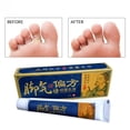 thumbnail image 1 of Crema para eliminar hongos en los pies Sincero 15g, 1 of 10