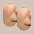 thumbnail image 5 of Trophy Skin Microcurrent Lifting Gel for RejuvatoneMD Facial Toning System 2 oz, 5 of 6