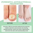 thumbnail image 2 of 20ML Nutraboost Nail Fungus Treatment Gel, Natural Nail Repair Strengthening Gel 1/3/5x, 2 of 5