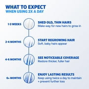 Mens Rogaine 5% Minoxidil Foam Hair Loss Treatment, 1-Month Supply
