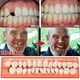 thumbnail image 1 of Modelo De Dientes De Resina Dentaduras Duraderas Dientes Postizos Universales Resi 28 Unids/Set Vogacara  CE003654-00, 1 of 6
