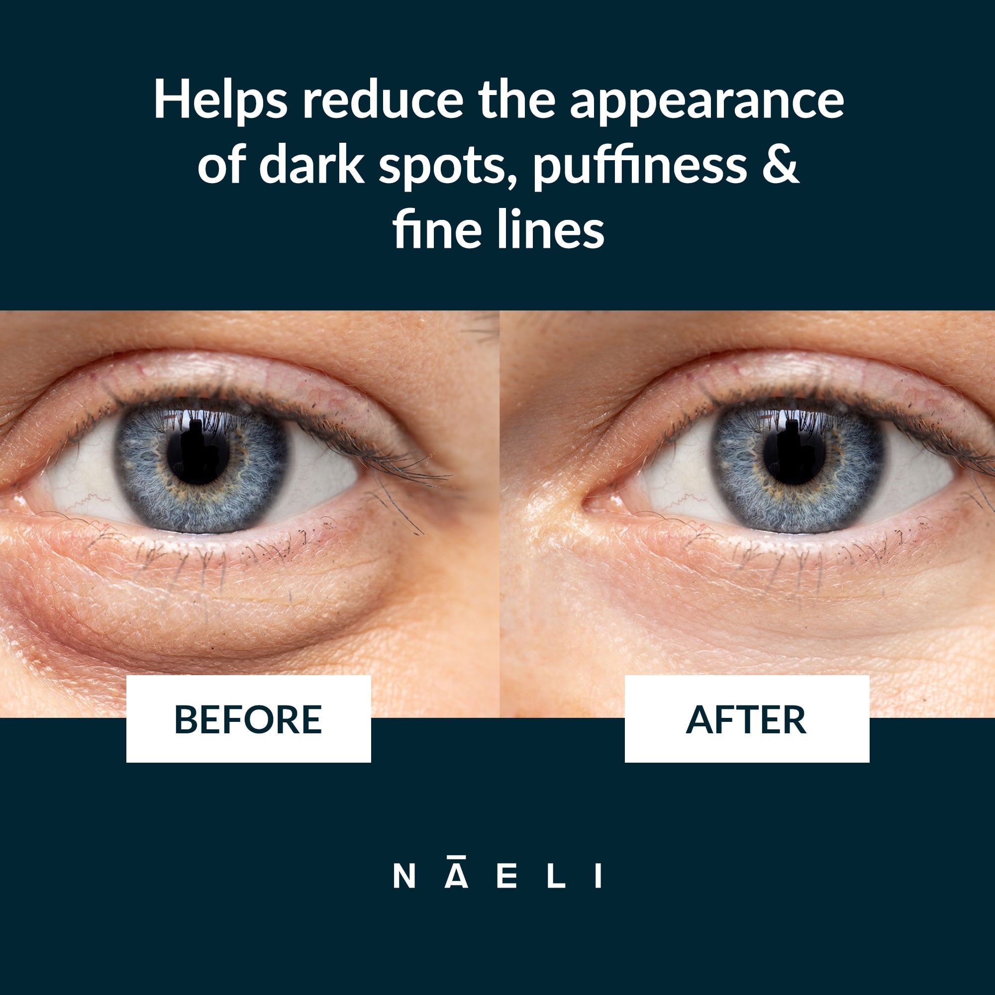 NAELI Eye Cream for Dark Circles and Puffiness with Peptides, 1.4 oz