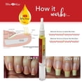 thumbnail image 2 of Pluma de Aceite para Cutículas Bliss Kiss Sin Fragancia con Vitamina E, 2 of 7