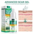 thumbnail image 2 of Silicone Scar Gel - Medical Advanced Scar Gel Gentle Formula 50ml, 2 of 3