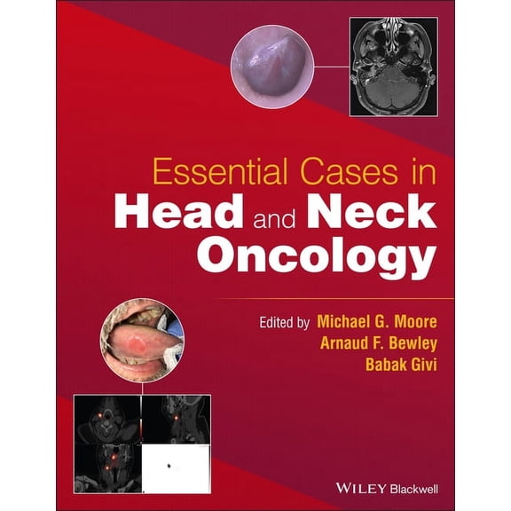 Essential Cases in Head and Neck Oncology (Paperback)