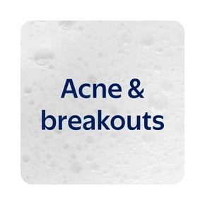 Acne & breakouts.