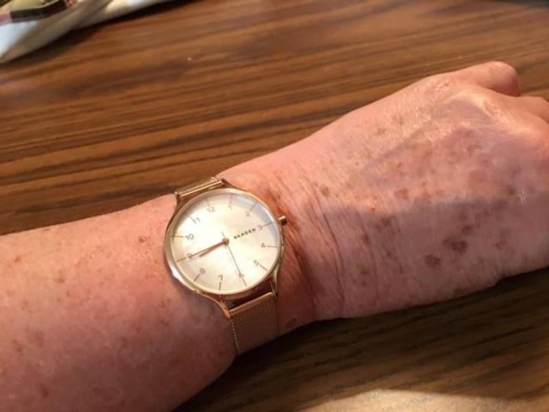 Skagen top anita skw2633
