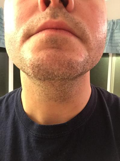 philips norelco beard trimmer 3500 walmart