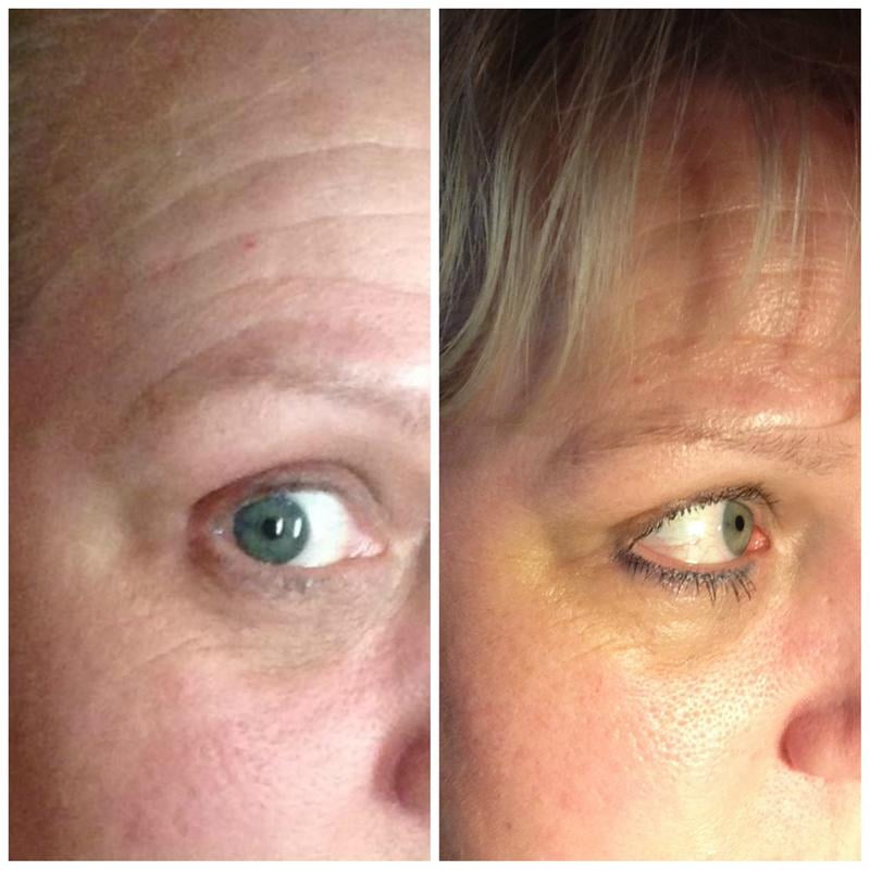 ponds rejuveness reviews