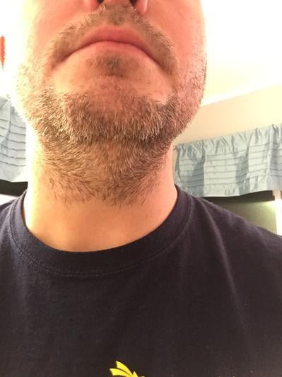 philips norelco beard trimmer 3500 walmart