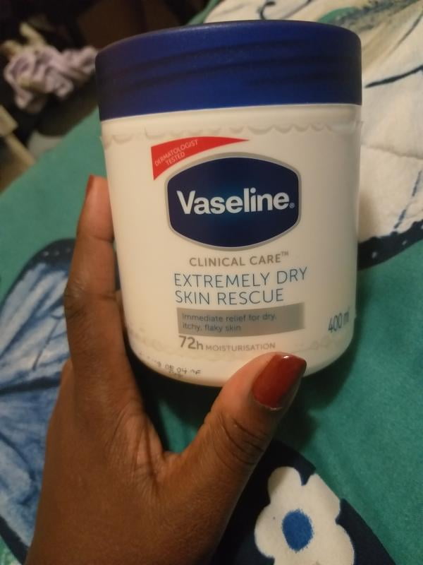 vaseline dry hands rescue