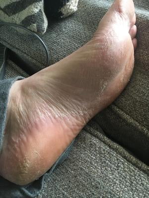 baby foot peel walmart