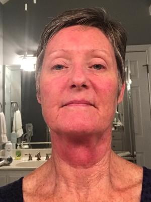 eucerin redness relief day cream