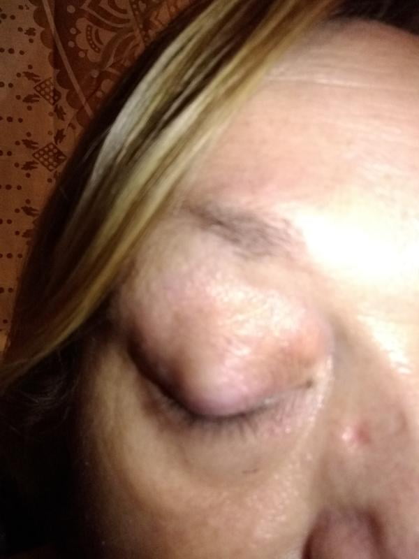 roc multi correxion crepe repair