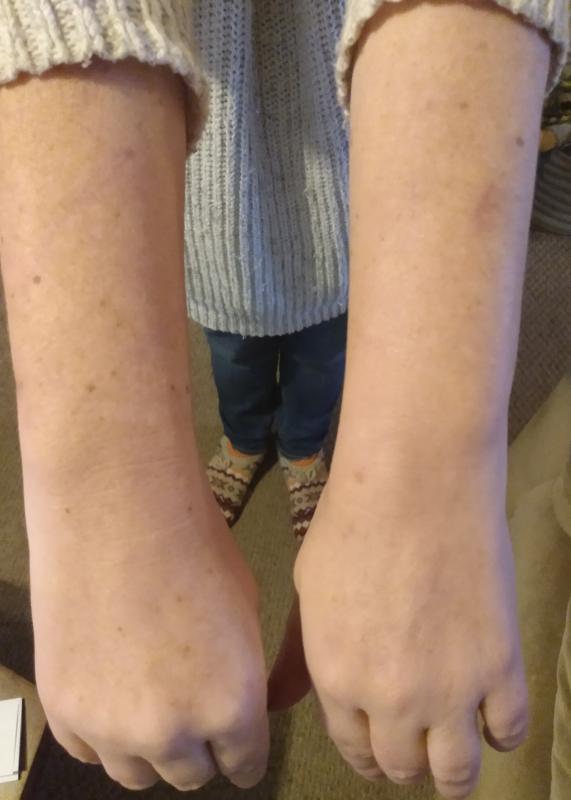 differin dark spot correcting serum