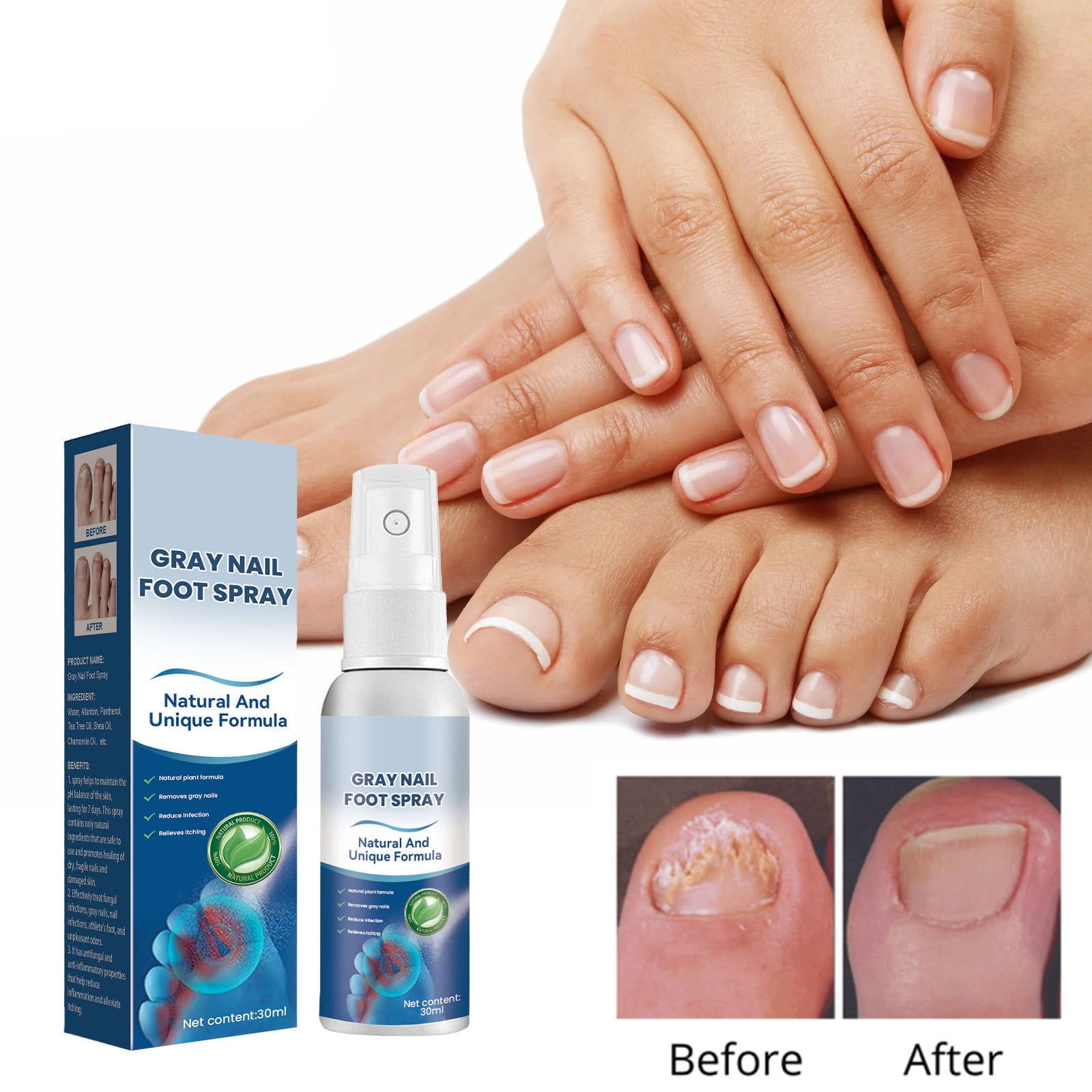 1/2/3PCS Fungal Nail Feet Care Essence Onychomycosis Foot ToeNail
