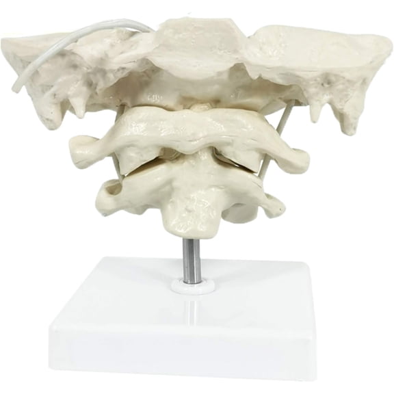 1.5X Human Cervical Spine & Occiput Model - Movable Atlas Axis Anatomy Model PVC Medical Teaching Aid for Chiropractic, Physical Therapy, Student Learning & Office Decor