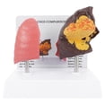 thumbnail image 1 of AURARMLET Lung Model For Anatomy Lung Comparison Model Multi 1 Pc 7.9x7.1x5.5in, 1 of 5