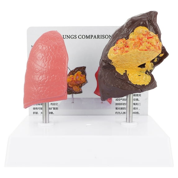 AURARMLET Lung Model For Anatomy Lung Comparison Model Multi 1 Pc 7.9x7.1x5.5in